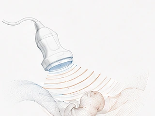 Ultrasound illustration