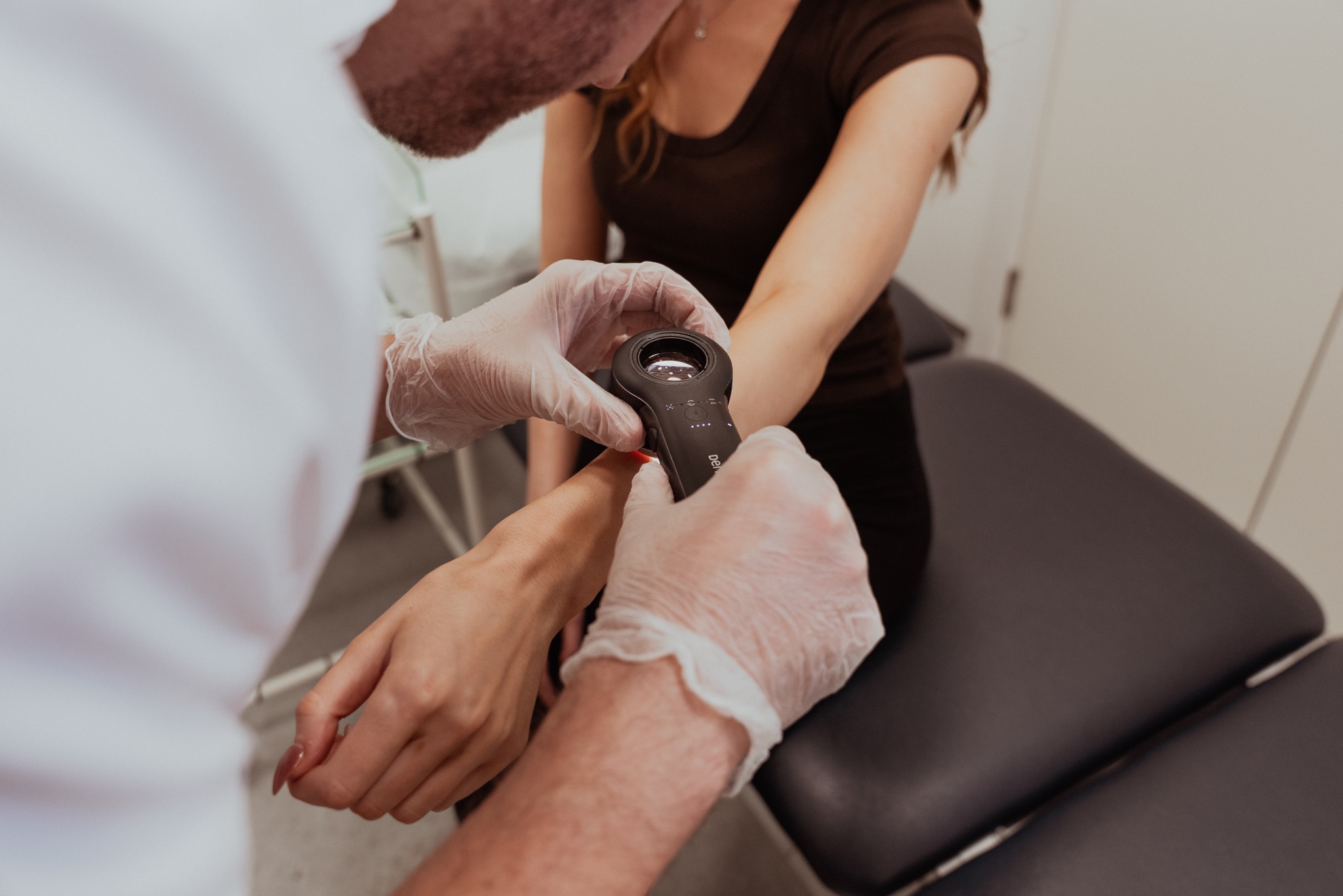 Suspicious mole removal and biopsy consultation